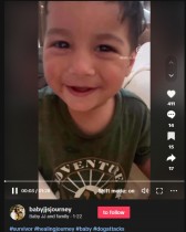 【海外発！Breaking News】「喉の奥まで見えた」ピットブルに顔を引き裂かれた男児の父、規制強化を訴え（米）＜動画あり＞