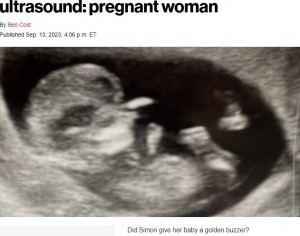 ヘイリーさんがFacebookで写真をシェアすると、「似てる！」「サイモン・コーウェルに見えるなんて、なんだか不気味だわ」などと大きな反響があった（画像は『New York Post　2023年9月13日付「I see ‘American Idol’ judges in my ultrasound: pregnant woman」（Kennedy News ＆ Media）』のスクリーンショット）
