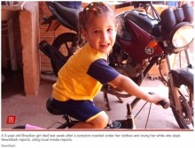 【海外発！Breaking News】就寝中にサソリに刺された3歳女児、治療を受けるも6日後に死亡（ブラジル）