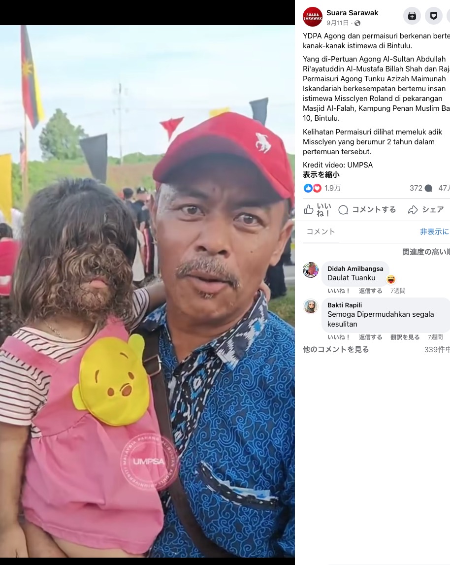 多毛症を患って生まれてきたアディクちゃん（左）を腕に抱く父親のローランドさん（画像は『Suara Sarawak　2023年9月11日付Facebook「YDPA Agong dan permaisuri berkenan bertemu kanak-kanak istimewa di Bintulu.」』のスクリーンショット）