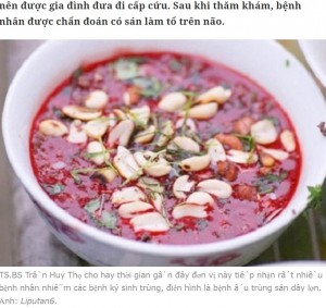 ベトナム料理で「生血プリン」などと呼ばれる“ティエットカイン”を月1回食べていた女性。今年1月、女性の脳や体から寄生虫が発見された（画像は『Zing　2023年4月11日付「Sán làm tổ trên não vì thích ăn tiết canh giải nhiệt」（Ảnh: Liputan6）』のスクリーンショット）