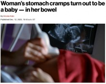 【海外発！Breaking News】激しい腹痛で病院に駆け込み、子宮外妊娠が判明　腹腔内の胃腸の横で胎児が成長（仏）