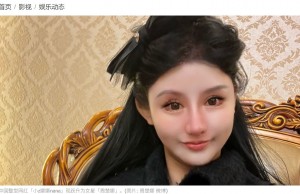 2年前の楚娜さん。13歳の時とは別人のようで、どんどん顔が変わっていった。またこれまでに鼻、唇、小顔整形（骨切り）、脂肪吸引、豊胸、豊尻、ヒアルロン酸注射などをはじめ、考えられるほぼすべての整形手術を受けてきたという（『希望之声　「中国网红跃升为女星 整型上百次频换身分证」（图片: 小z娜娜nana 微博）』より）