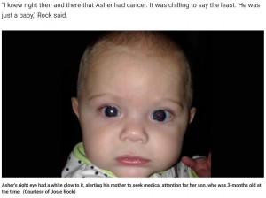 米ジョージア州在住の母親は1014年、生後3か月だった息子の写真を見て白く反射する片目に違和感を覚えた。病院へ連れて行くと、網膜芽細胞腫という目のがんであることが判明した（『Fox News　「iPhone photo helps Georgia mom discover her son’s rare eye cancer」（Courtesy of Josie Rock）』より）
