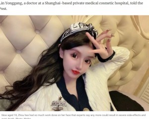 楚娜さんは『微博』に「小z娜娜nana」の名で写真や動画を投稿しており、「かわいそうな女性だ」「怖い」「まるでアニメのキャラクターのよう」といった声もあがっている（『South China Morning Post　「Star-struck China teenage girl splurges US＄563,000 of parents’ cash on so much plastic surgery doctors fear one more op could kill her」（ Photo: SCMP composite/Weibo）』より）