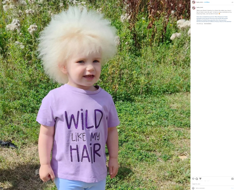 まるでタンポポの綿毛のようにフワフワの髪を持つイギリスのレイラちゃん。1歳の頃に「櫛でとかせない頭髪症候群」と診断された（『Layla Davis　Instagram「Wild like my hair」』より）