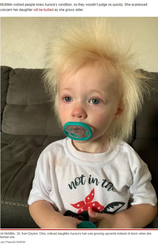 米オハイオ州に暮らす3歳のオーロラちゃんも「櫛でとかせない頭髪症候群」だ。2022年12月、母親が「この病気について知って欲しい」とTikTokで訴えていた（『New York Post　「My tot has Albert Einstein hair ― trolls call me irresponsible for not taming it」（Jam Press/Ali McMillin）』より）