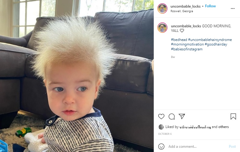 米ジョージア州に住むロックラン君（1）も「櫛でとかせない頭髪症候群」だ。母親は2021年、息子についてSNSで「人と違うことはユニークで誇り」と明かしていた（『Locklan Evers　Instagram「GOOD MORNING, YALL」』より）