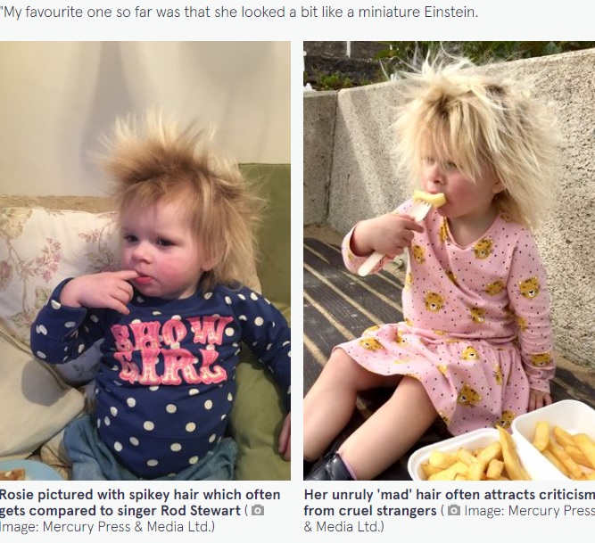 英イースト・ライディング・オブ・ヨークシャー在住のロージーちゃん（3）も「櫛でとかせない頭髪症候群」だ。母親が2022年4月、メディアのインタビューで「なぜ髪をとかさないの？」と言われることを明かしていた（『The Mirror　「Mum of girl with unruly hair due to condition told ‘brush it’ by cruel strangers」（Image: Mercury Press ＆ Media Ltd.）』より）