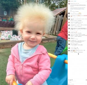 シャーロットさんは何人かに「この子の髪は普通と違う」と言われており、レイラちゃんが爪の感染症に3、4回罹ったこともあり、1歳の頃にUHSの検査を受けたという（『Layla Davis　Instagram「Hello, my name is Layla.」』より）
