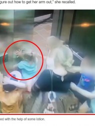 【海外発！Breaking News】エレベーターの戸袋に腕を引き込まれた5歳少女、20針縫う大ケガ（米）＜動画あり＞