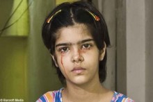 【海外仰天ニュース】インド発、目から出血する奇病、13歳の少女を助けてあげて！